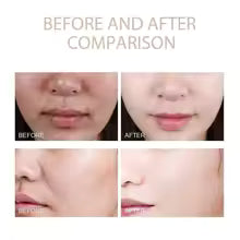 Dr. Melaxin Rice Exfoliating Serum Facial Moisturizing